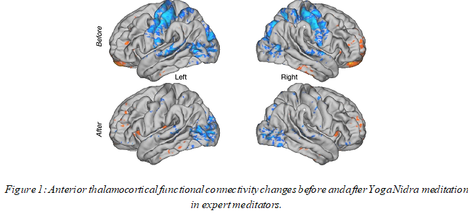 Impacts of Meditation on Brain